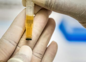 Un campione di urina