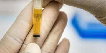 Un campione di urina