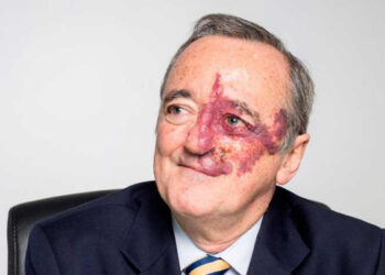 Ecco chi è Mariano Barbacid, l'oncologo che avrebbe trovato la cura per il tumore al pancreas