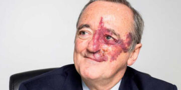 Ecco chi è Mariano Barbacid, l'oncologo che avrebbe trovato la cura per il tumore al pancreas