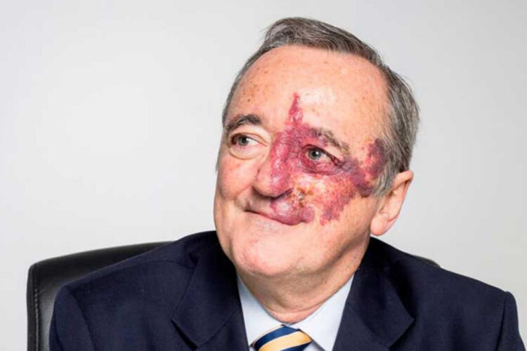 Ecco chi è Mariano Barbacid, l'oncologo che avrebbe trovato la cura per il tumore al pancreas