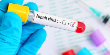 Virus Nipah