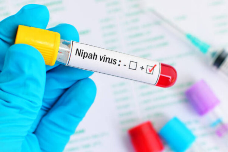 Virus Nipah