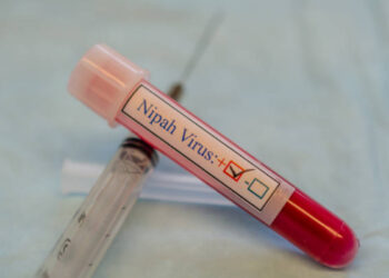 Virus Nipah