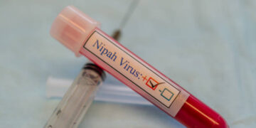 Virus Nipah