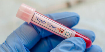 Vaccino per il virus Nipah