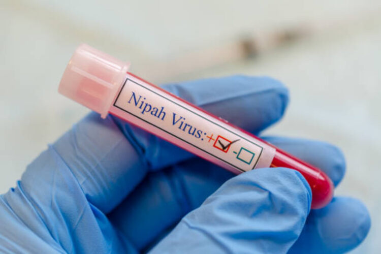 Vaccino per il virus Nipah