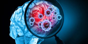 Caso di meningite alla Torre Gioia 22 a Milano