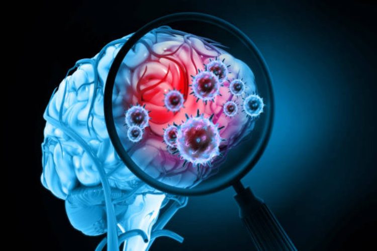 Caso di meningite alla Torre Gioia 22 a Milano