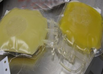 Delle sacche di plasma