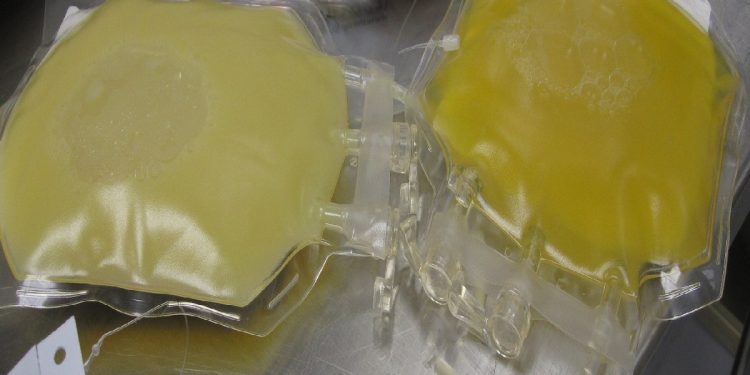 Delle sacche di plasma