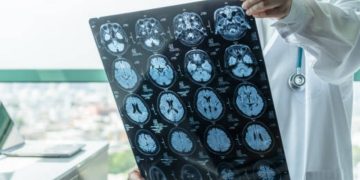 Epidemia di meningite in Inghilterra