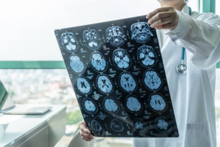 Epidemia di meningite in Inghilterra