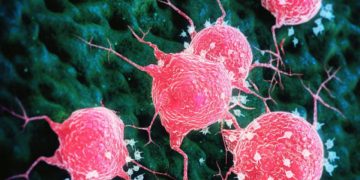 Nuova scoperta sui tumori