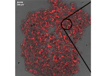Tumore alla mammella