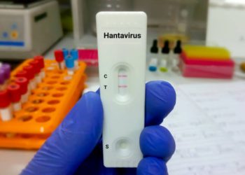 Hantavirus