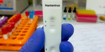 Hantavirus