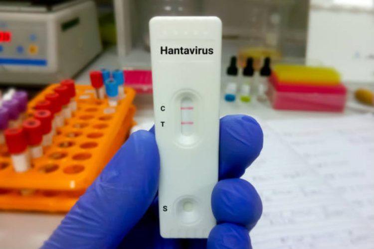 Hantavirus