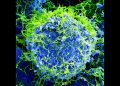 Il virus Ebola