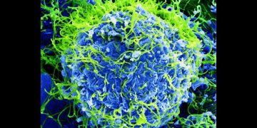 Il virus Ebola