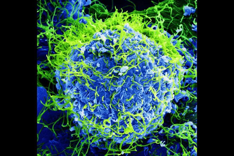 Il virus Ebola