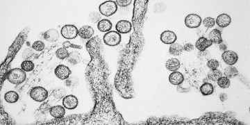 hantavirus