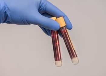 immagine di due provette di sangue