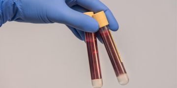 immagine di due provette di sangue
