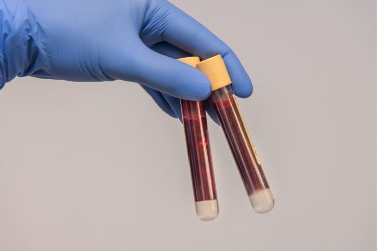 immagine di due provette di sangue