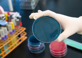 Test sulla salmonella
