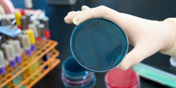 Test sulla salmonella