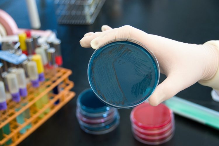 Test sulla salmonella