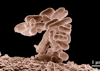 E coli at 10000x, original.jpg