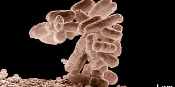E coli at 10000x, original.jpg