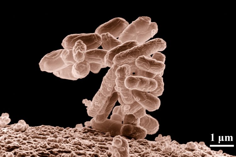 E coli at 10000x, original.jpg
