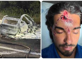 Temptation Island, l foto dell'incidente di Marco Fatata