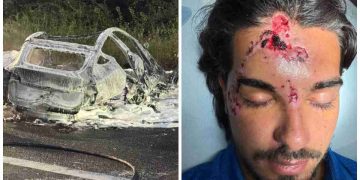 Temptation Island, l foto dell'incidente di Marco Fatata