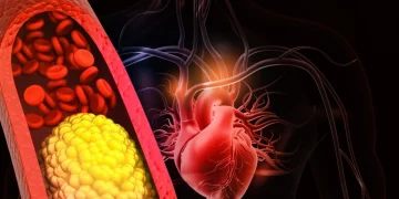 Nuove linee guida 2026 sul colesterolo obiettivi più bassi per molti