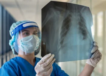 Operatrice sanitaria con DPI esamina radiografia polmonare in ospedale.