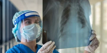Operatrice sanitaria con DPI esamina radiografia polmonare in ospedale.