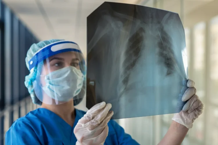 Operatrice sanitaria con DPI esamina radiografia polmonare in ospedale.