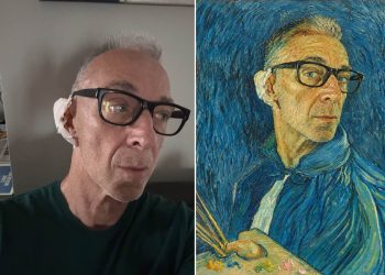 Linus con orecchio fasciato e occhiali neri, guarda dritto. Linus operato all’orecchio per un epitelioma, la benda in studio "in stile Van Gogh"