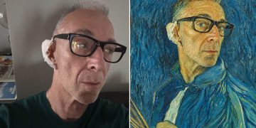 Linus con orecchio fasciato e occhiali neri, guarda dritto. Linus operato all’orecchio per un epitelioma, la benda in studio "in stile Van Gogh"