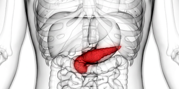 Pancreas rosso evidenziato in un corpo umano schematico. Al Policlinico Gemelli debutta YntraDose contro il carcinoma pancreatico non operabile
